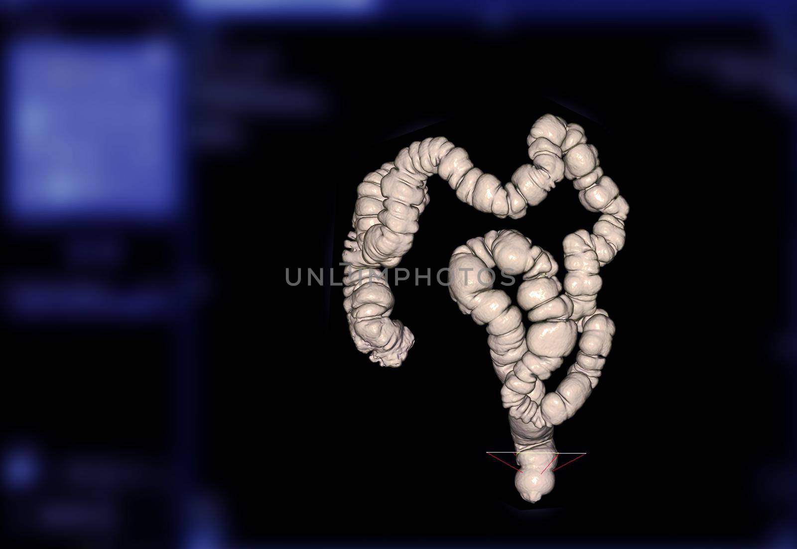 CT colonography or CT Scan of Colon 3D Rendering image. by samunella