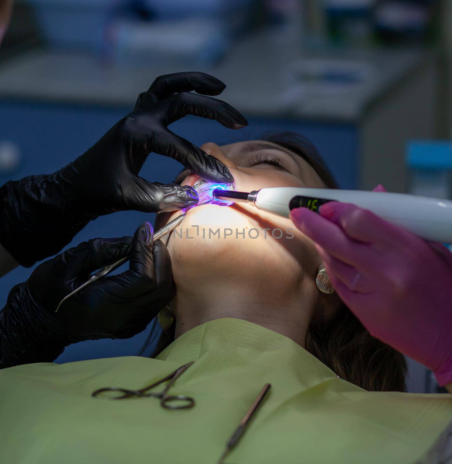 Installing a retainer after wearing braces. The process of removing braces.Beautiful woman in dental chair during procedure of installing braces to upper and lower teeth. Dentist and assistant working