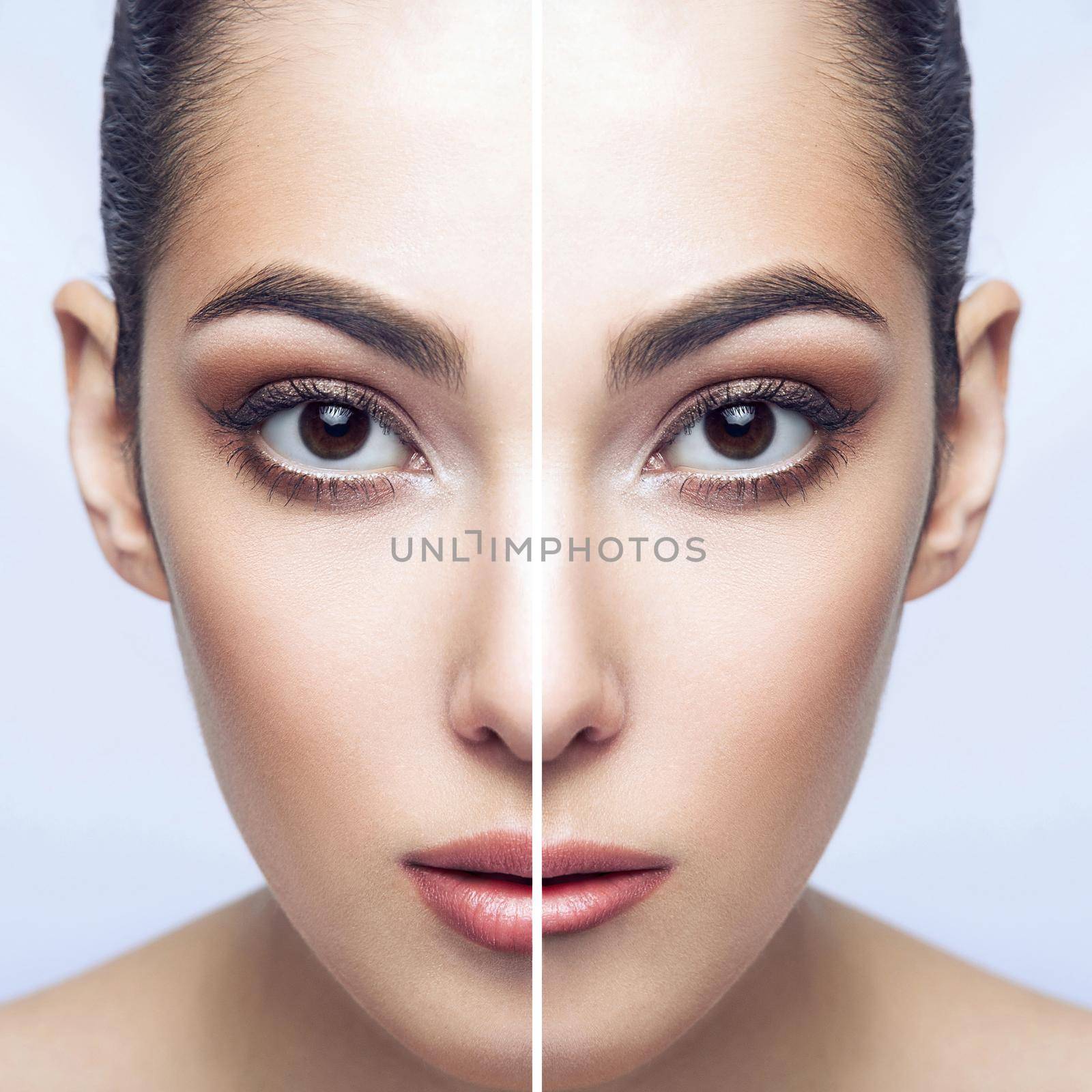 Before and after lip filler injections. Lip augmentation perfect lips. Closeup half portrait of beautiful brunette woman lips looking at camera. indoor studio shot, isolated on grey backgrond.