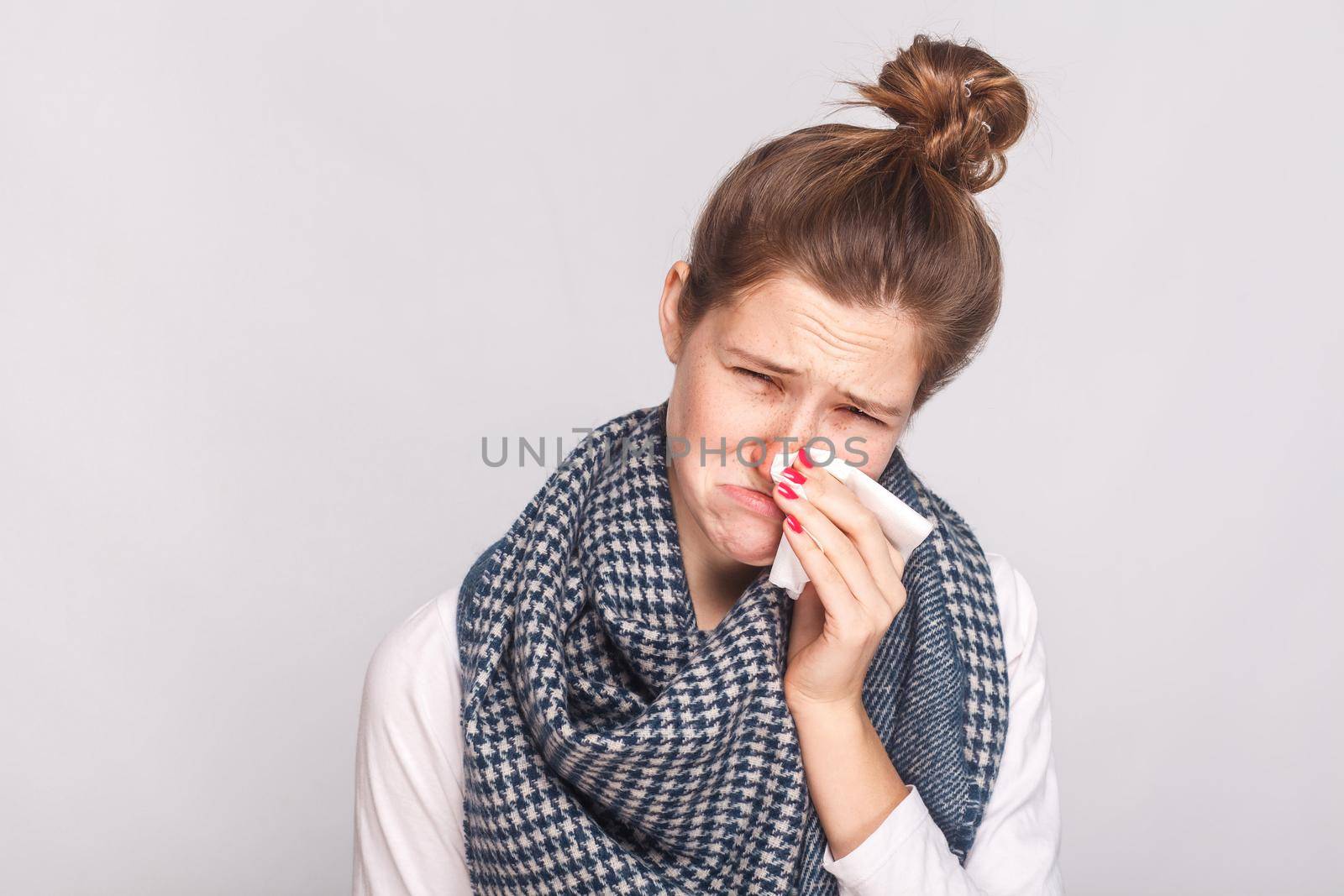 Allergy or virus concept. Closeup portrait of sick woman looking at camera by Khosro1