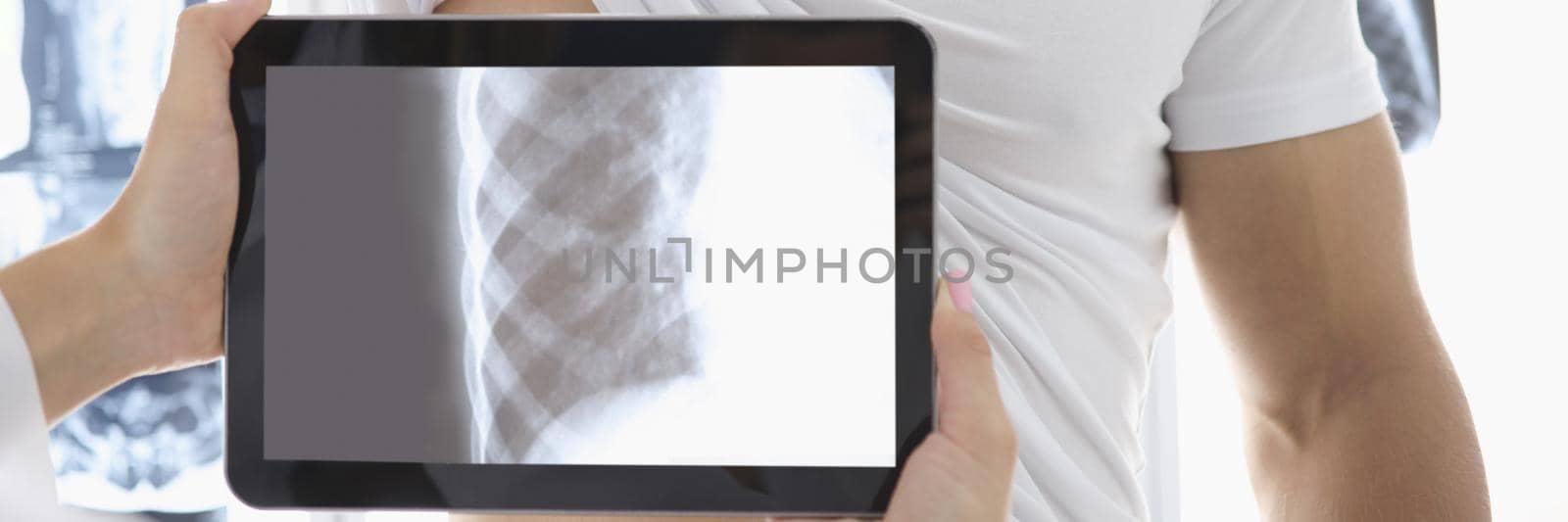 Medical worker put tablet device on patients body part and see ribs by kuprevich