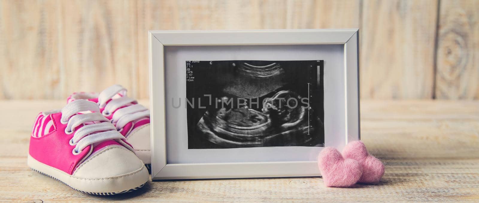 Ultrasound picture of a baby's photograph and accessories. Selective focus. child.