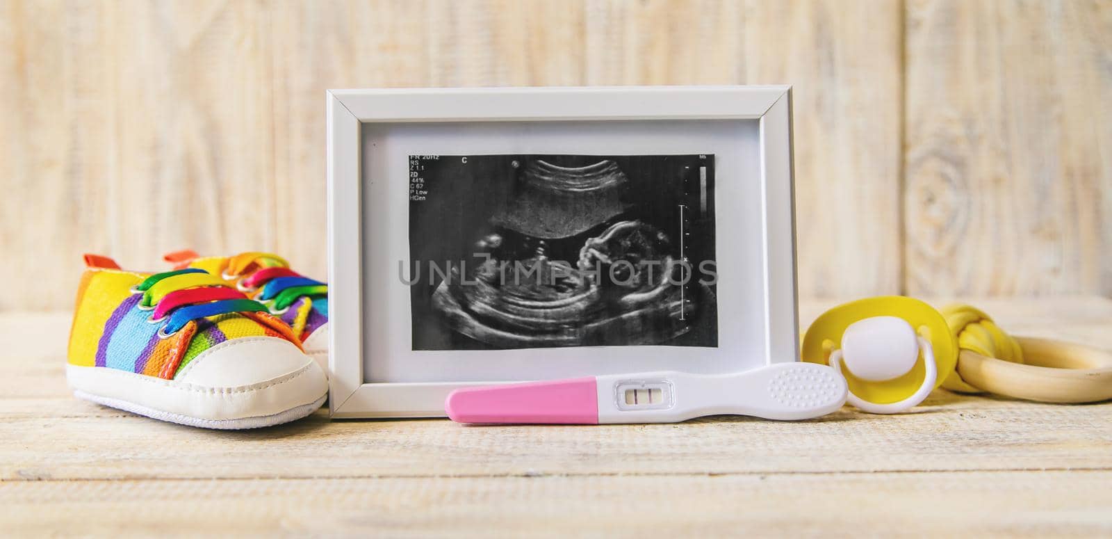 Ultrasound picture of a baby's photograph and accessories. Selective focus. by yanadjana