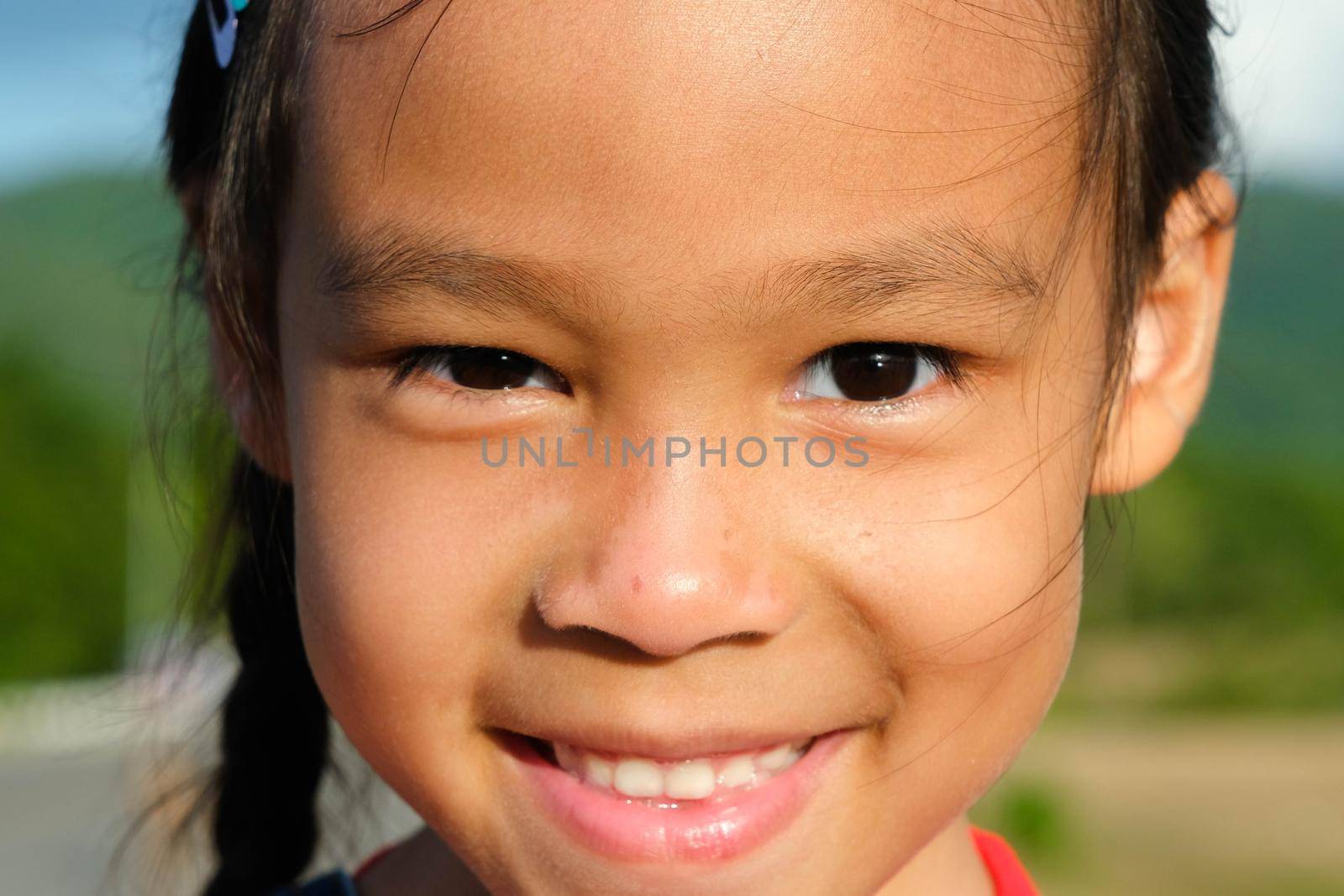 Healthy smiling face of a cute little girl with a sunburn on her face. Happy little Asian girl child showing front teeth with big smile and laughing. Beauty and health of the skin.