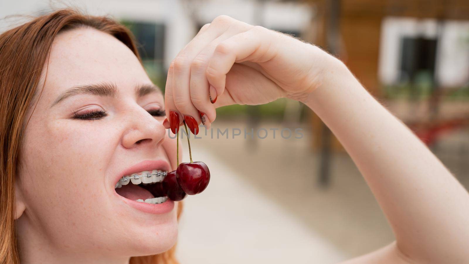 Beautiful young red-haired woman with braces on her teeth eats sweet cherries in the summer outdoors.