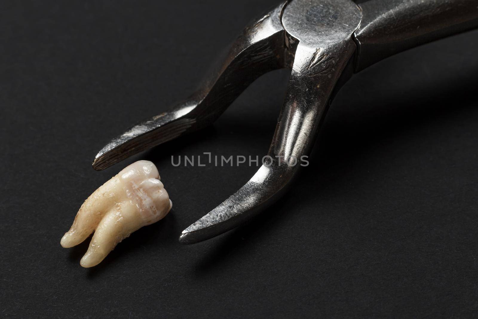 Stainless steel dental pliers and an extracted sick tooth on the black background. Medical tools.
