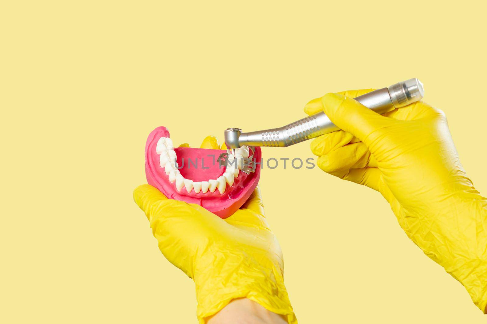 Head of high-speed dental handpiece with bur and a layout of the human jaw in dentist's hands on yellow. Dental instruments for dental treatment. Close-up view.