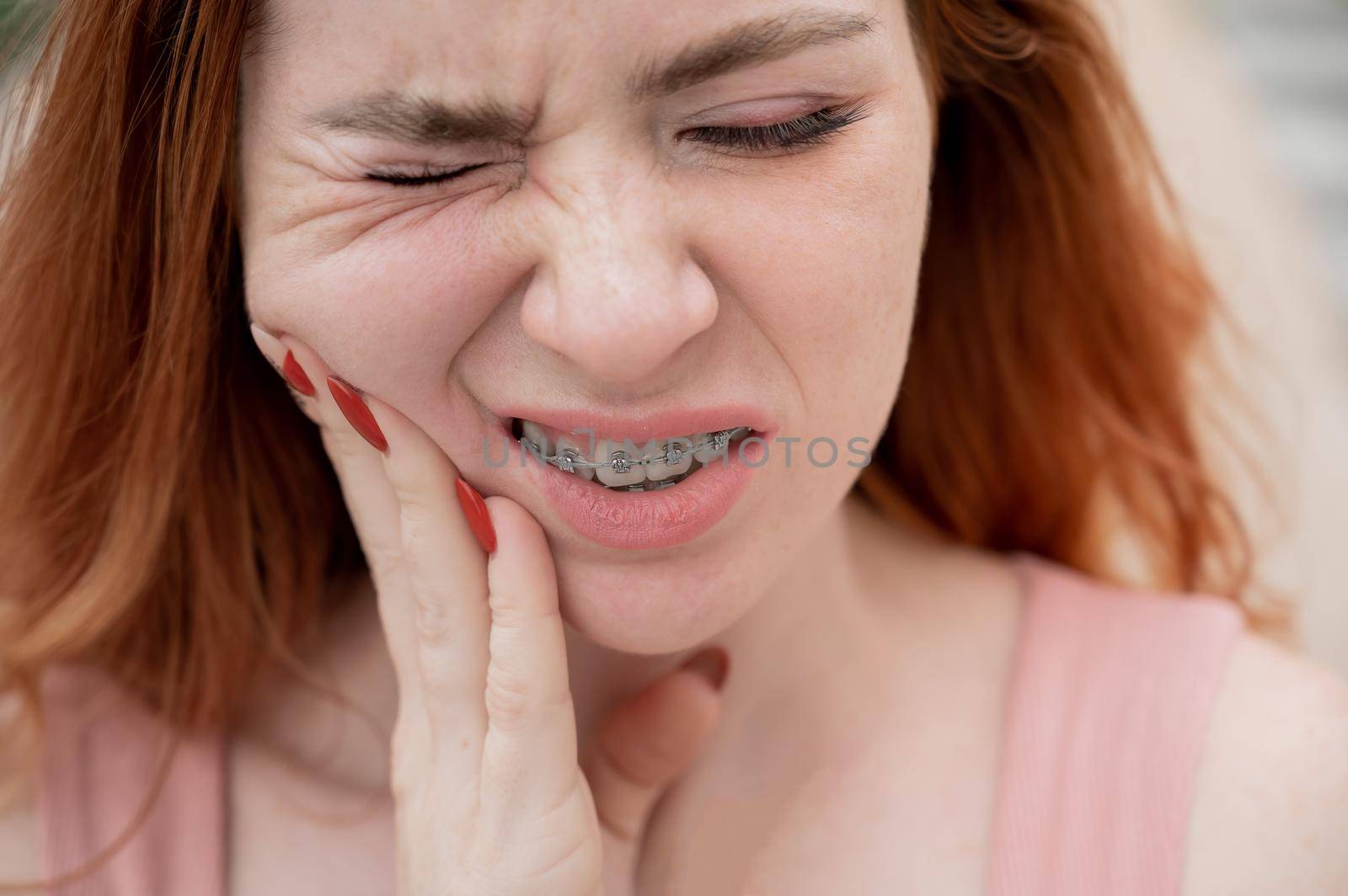 Young red-haired woman with braces suffering from pain