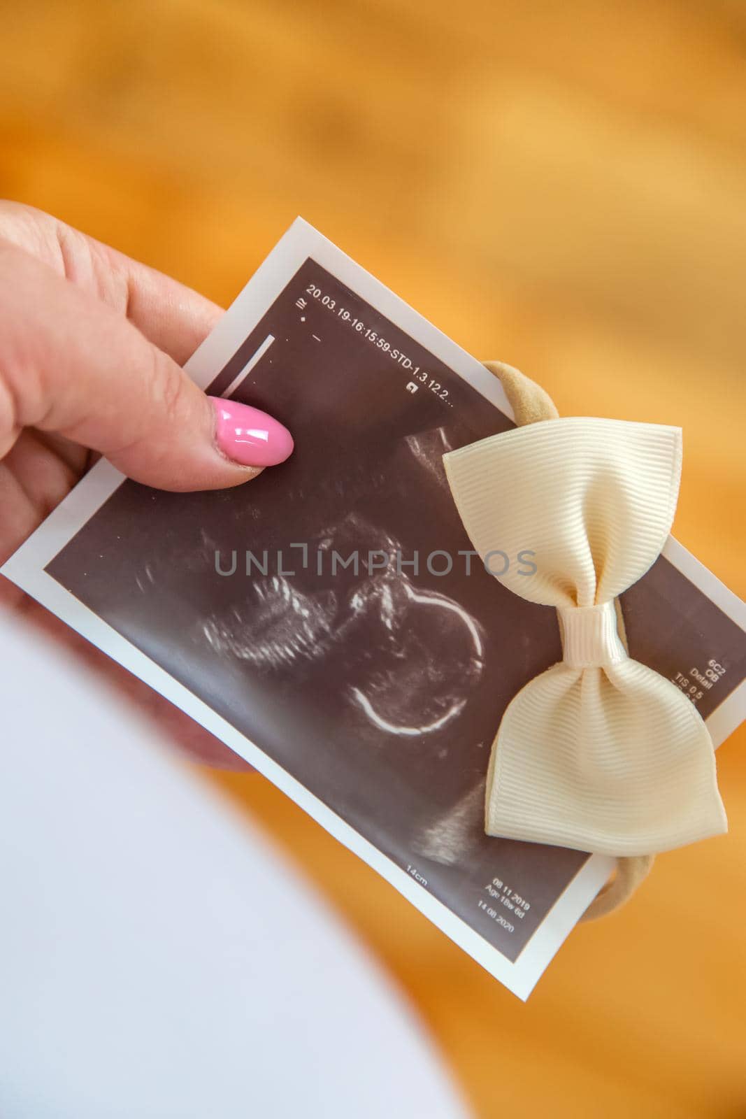 Pregnant woman with girl ultrasound picture. Selective focus. by yanadjana