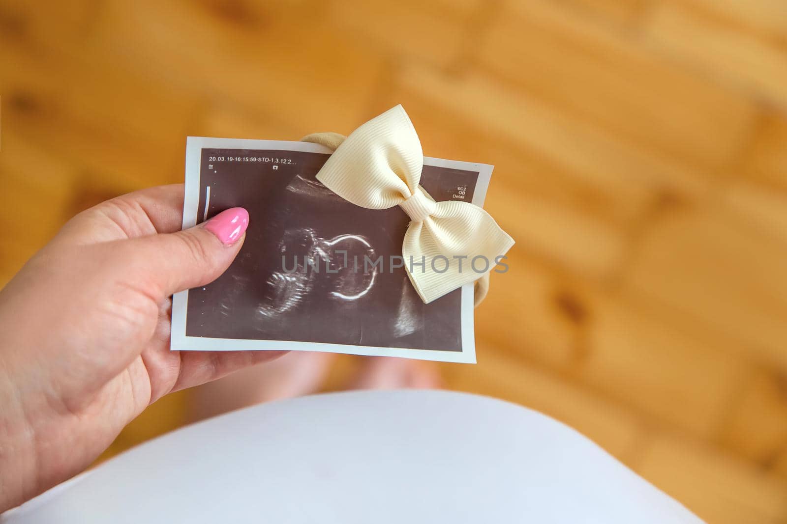 Pregnant woman with girl ultrasound picture. Selective focus. by yanadjana