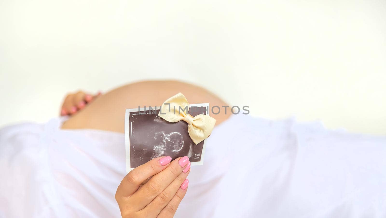 Pregnant woman with girl ultrasound picture. Selective focus. by yanadjana