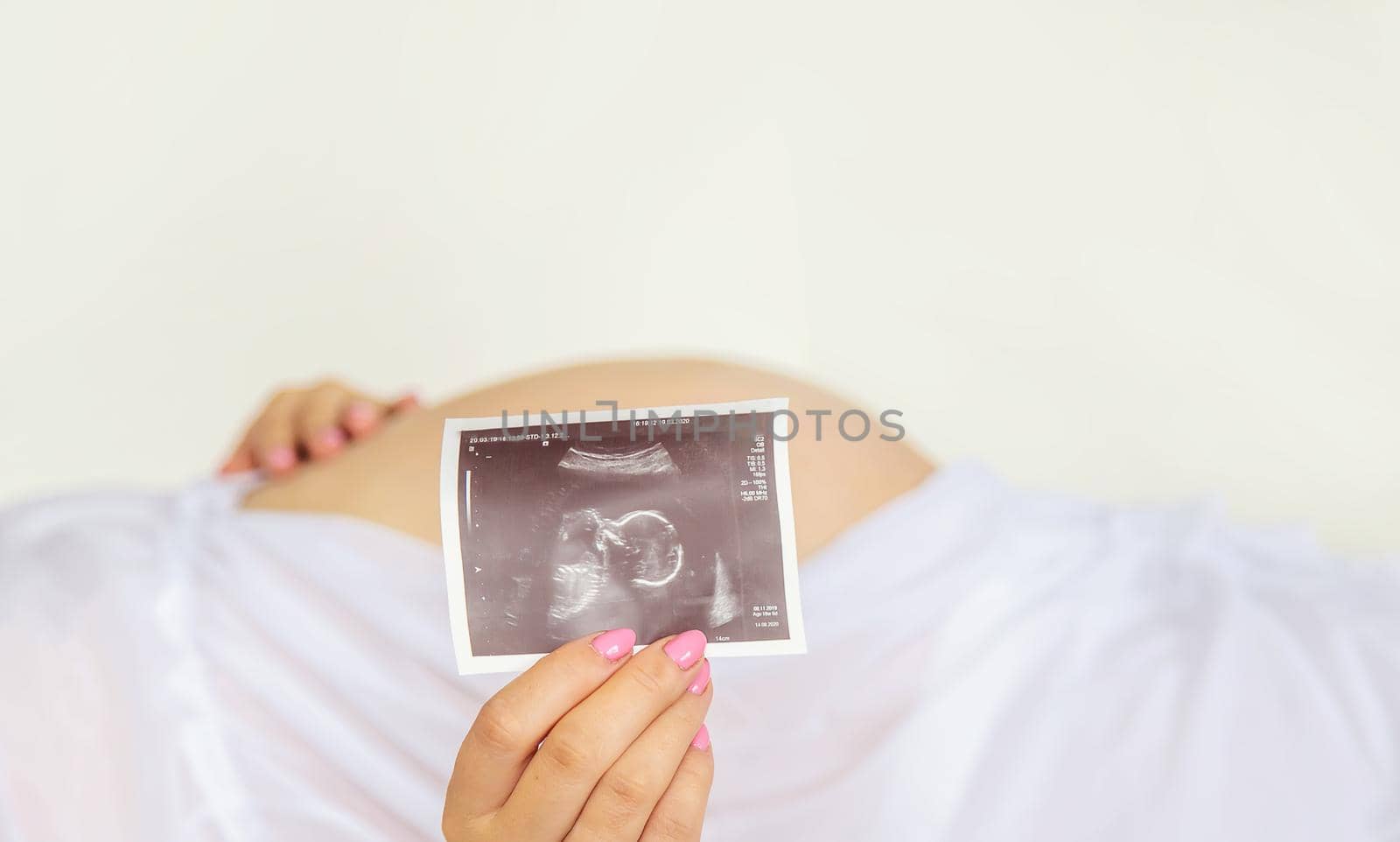 Pregnant woman with girl ultrasound picture. Selective focus. people.
