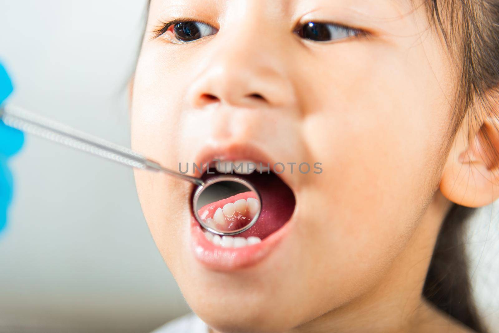 Doctor examines oral cavity of little child uses mouth mirror to checking teeth cavity by Sorapop