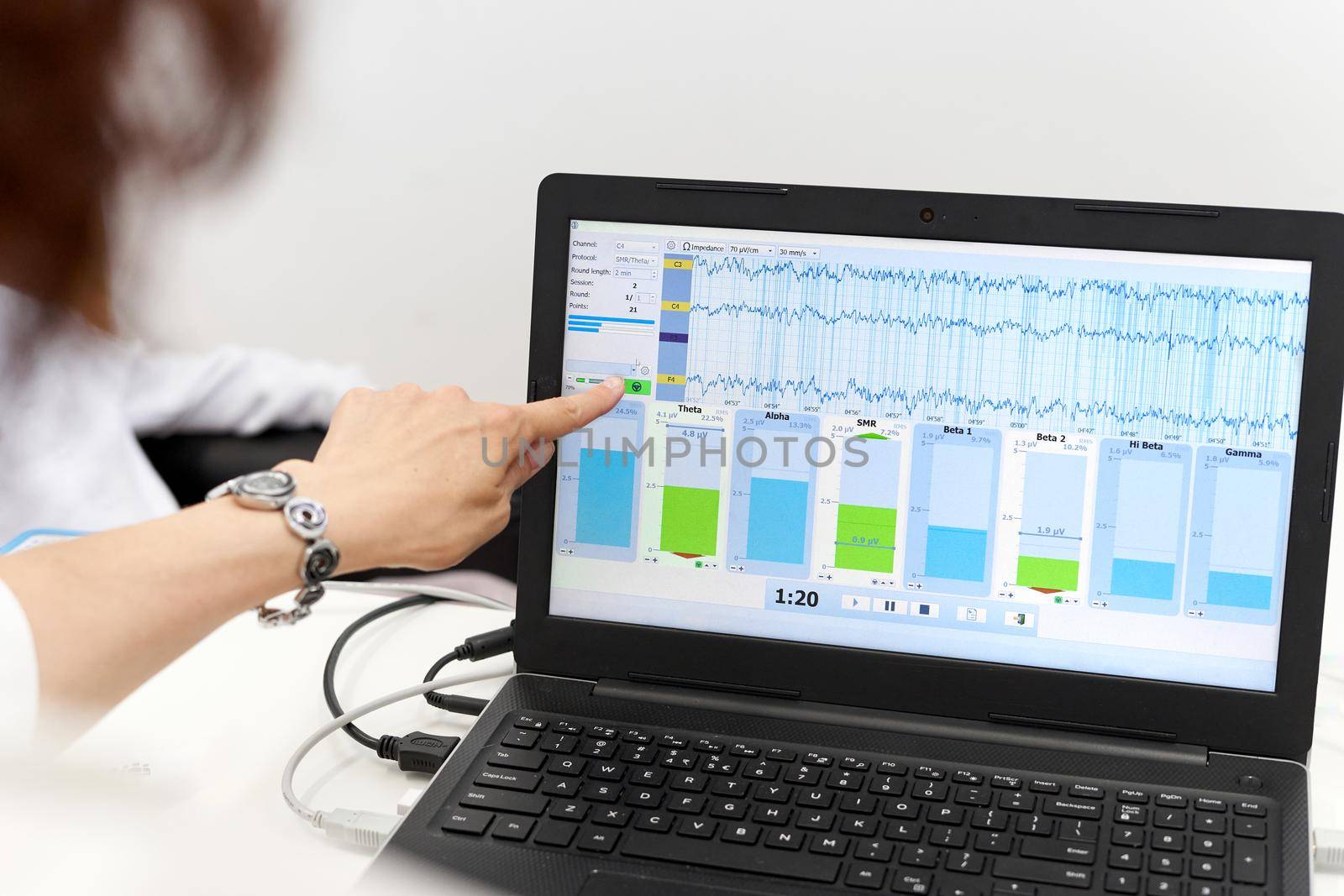 Doctor pointing the screen of a laptop during a biofeedback session by WesternExoticStockers