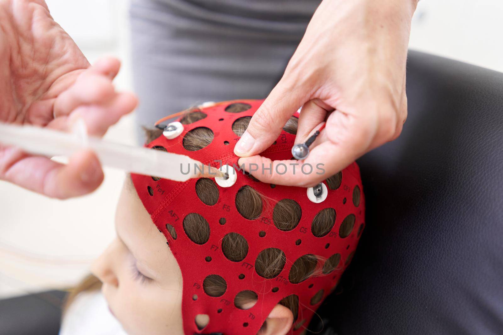 Doctor applying a liquid to a girl's headgear for biofeedback therapy by WesternExoticStockers