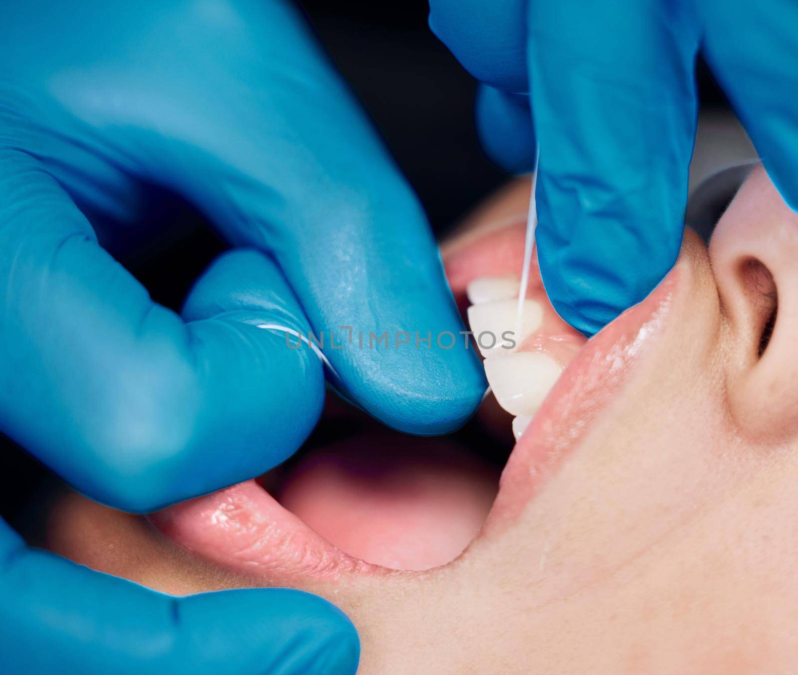 Doing it for them. Shot of a woman having her teeth flossed at the dentists office. by YuriArcurs