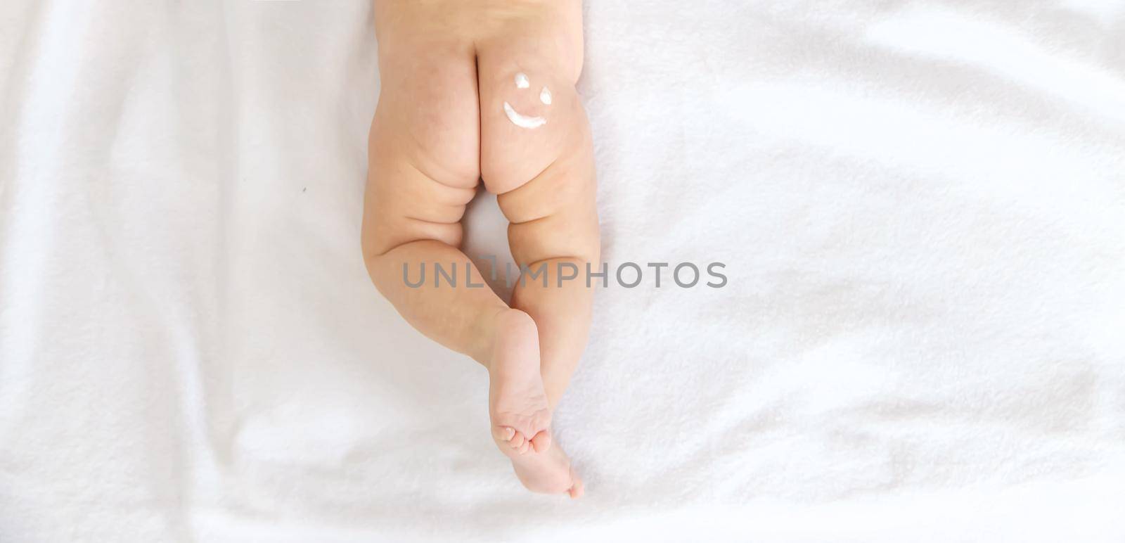 Smile sign on the baby's buttock with a cream. Selective focus. kid.