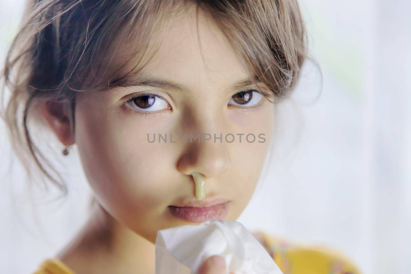 Snot in a child face close-up. Cold. Selective focus. by yanadjana