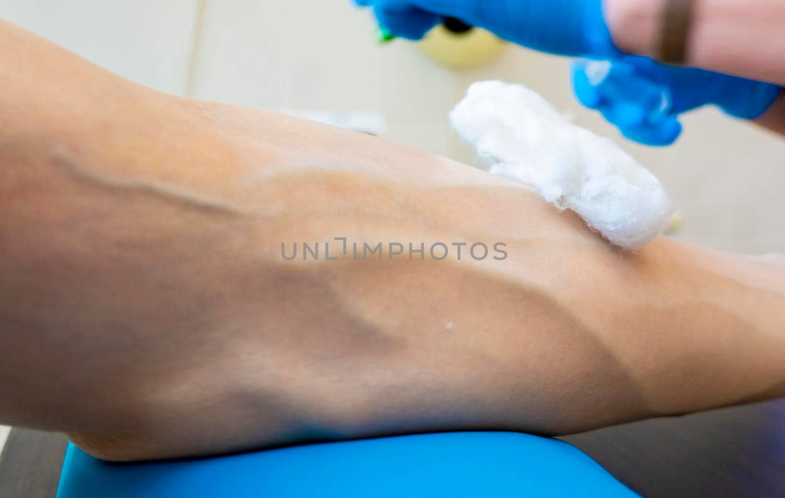 Close up nurse pricking needle syringe in the arm patient drawing blood sample for blood test