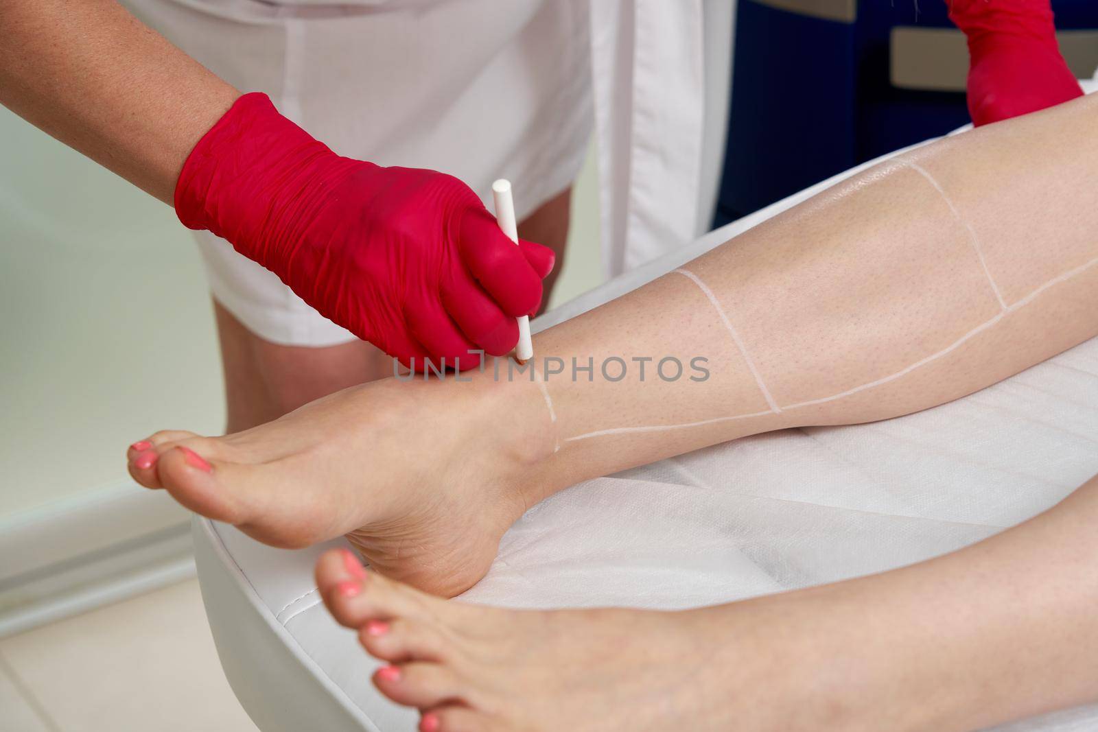 Cosmetologist preparing female patient for laser hair removal on legs