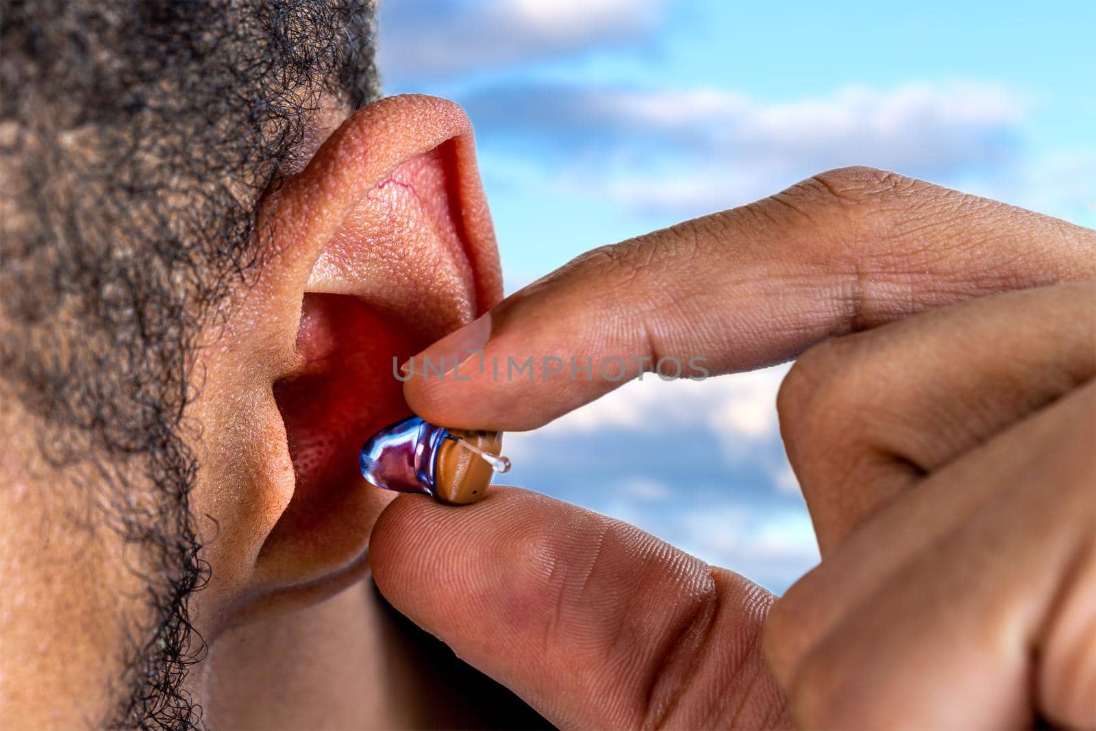 Hearing disorders in a young man-Digital Auditory. by JPC-PROD