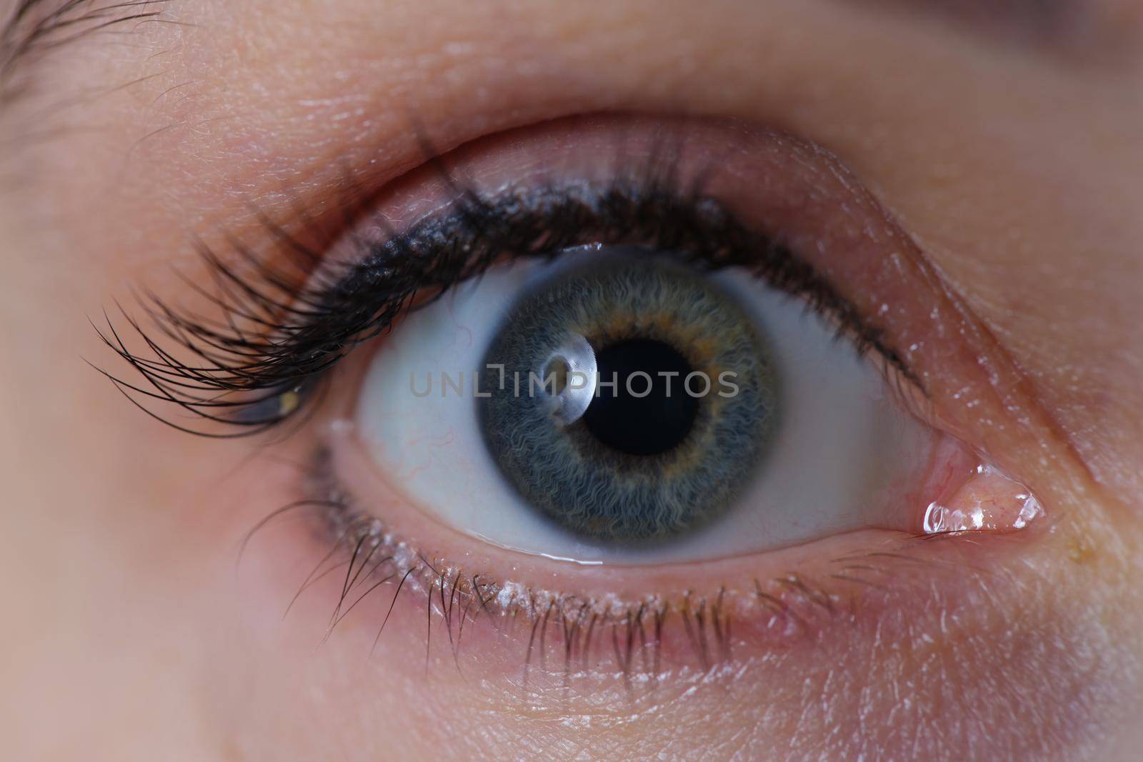 Wide open female eye with gray green pupil and a permanent arrow on eyelid. Laser vision correction concept