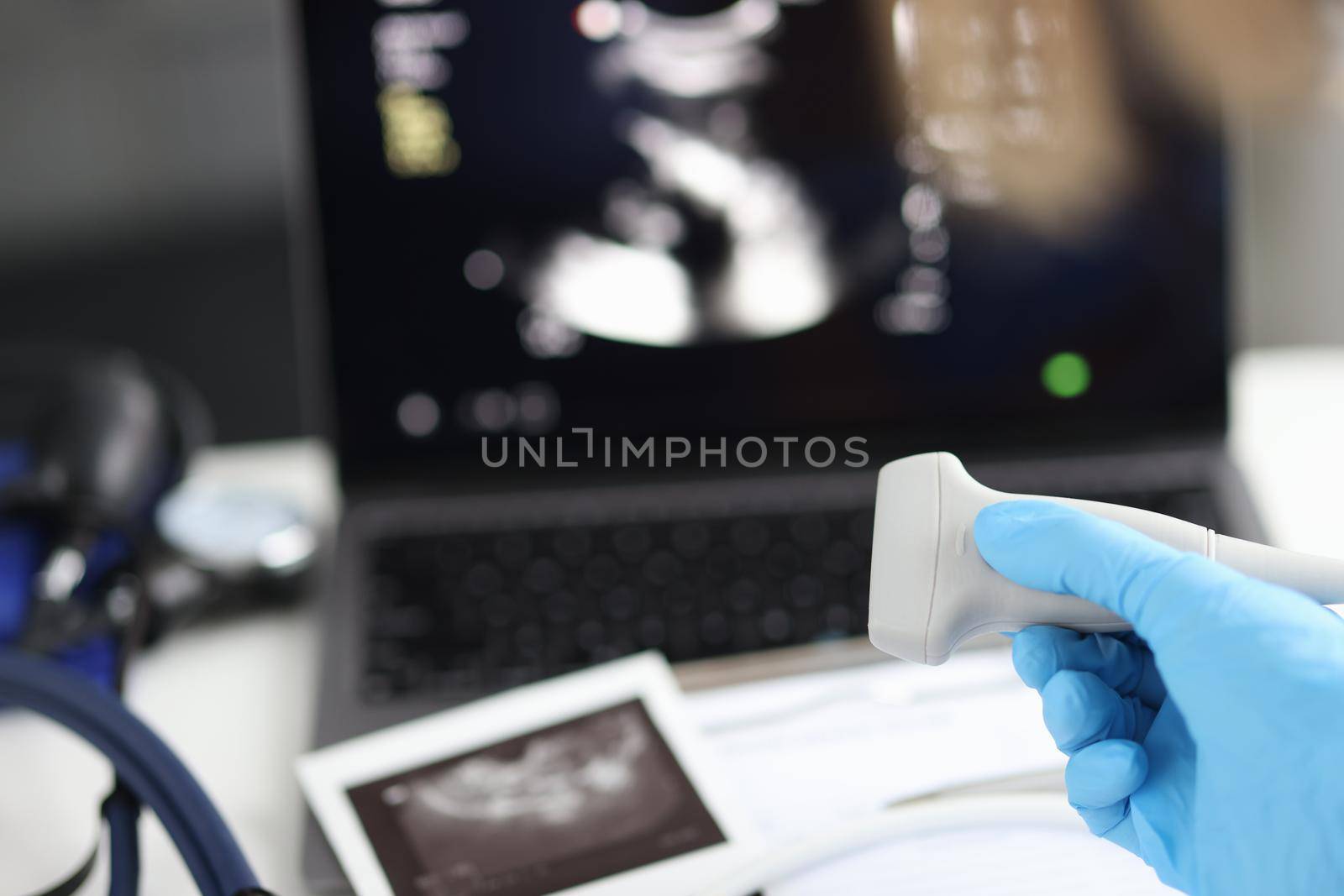 Doctor holds ultrasonic probe in hand preparing device for examination by kuprevich
