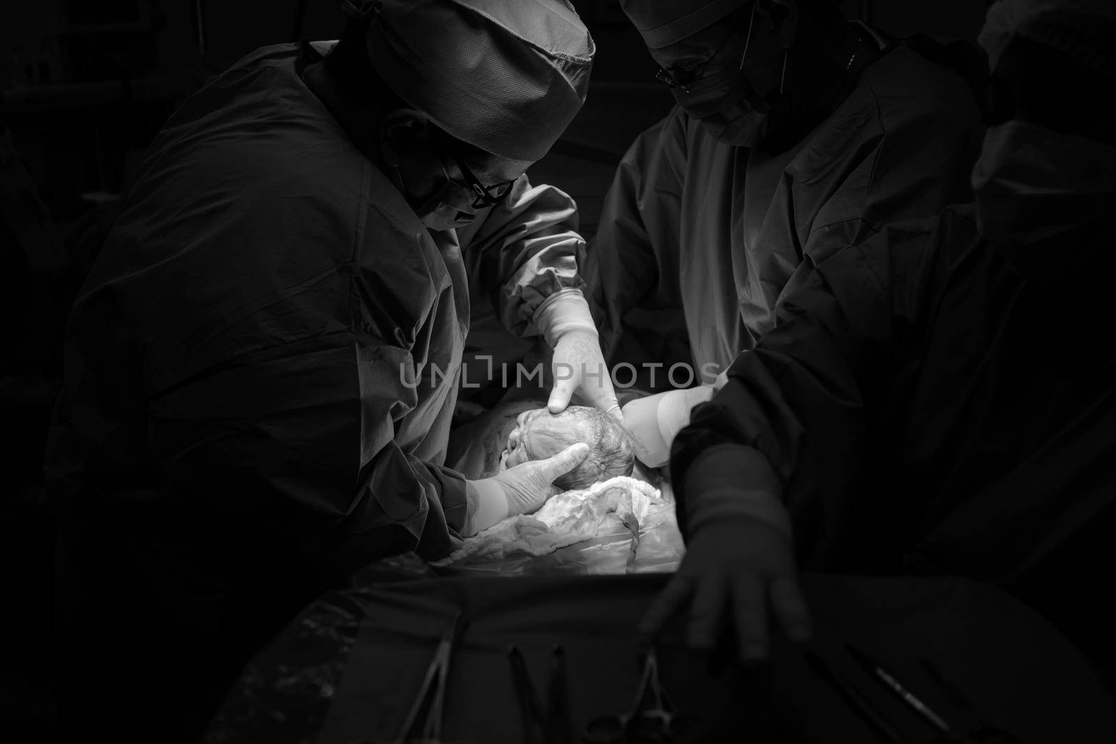 Cesarean section. The operation is in process. The child closeup