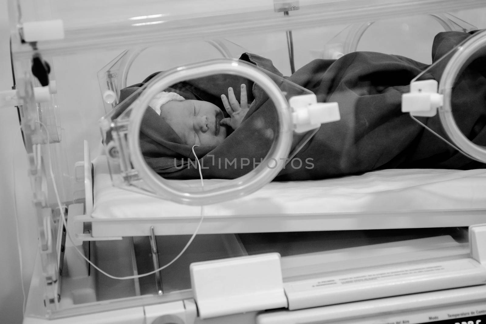 Newborn in the first few minutes of life in a hospital room.