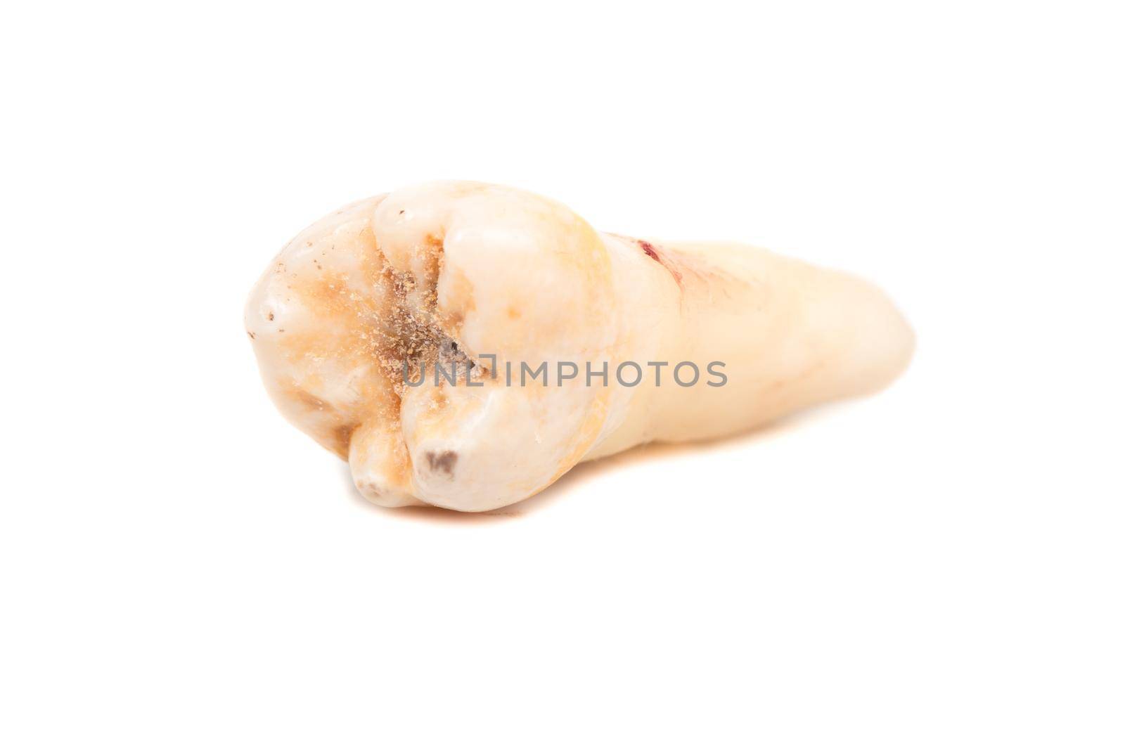 Patient is a human tooth isolated on white background