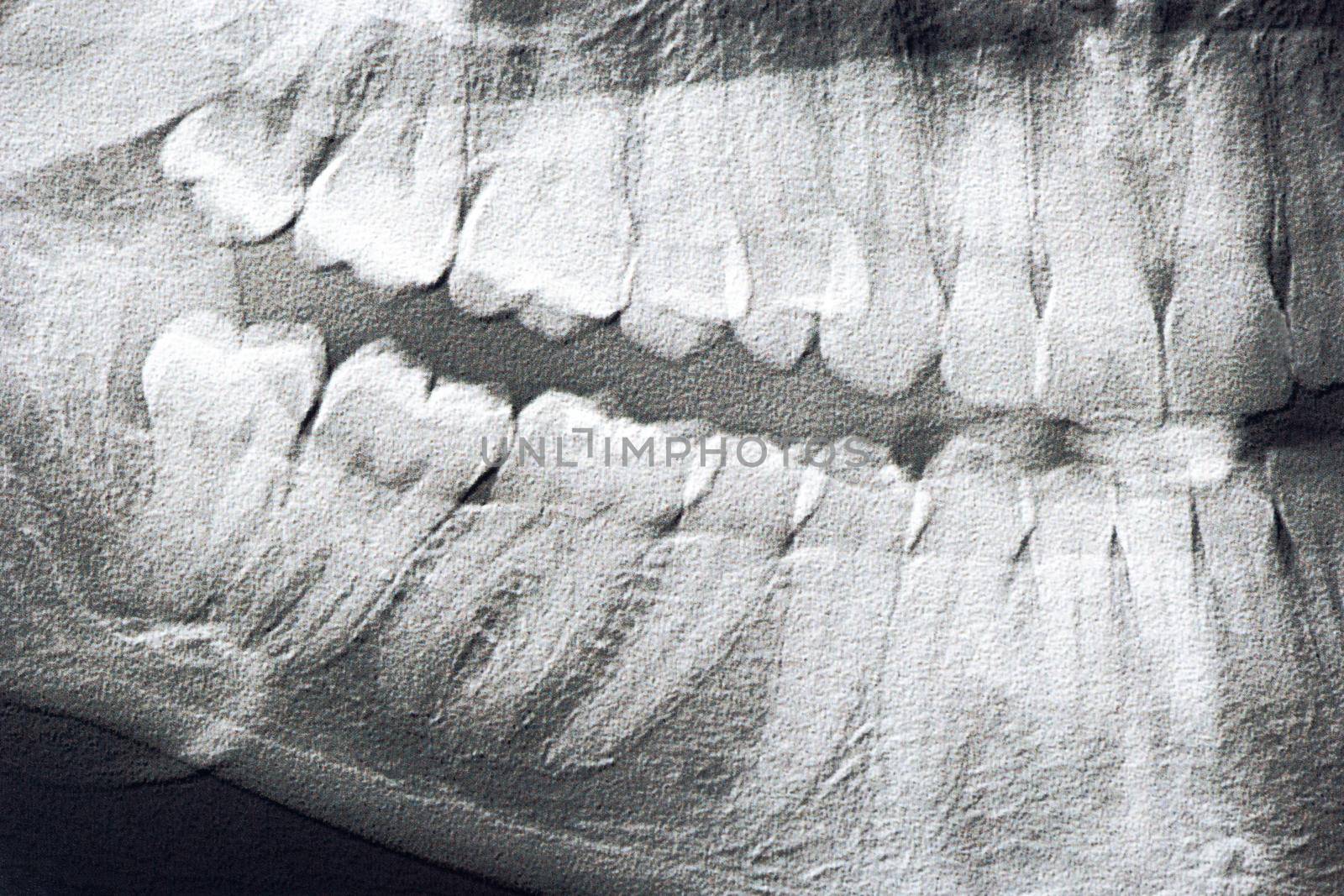 Panoramic x-ray of the jaw of the man close up