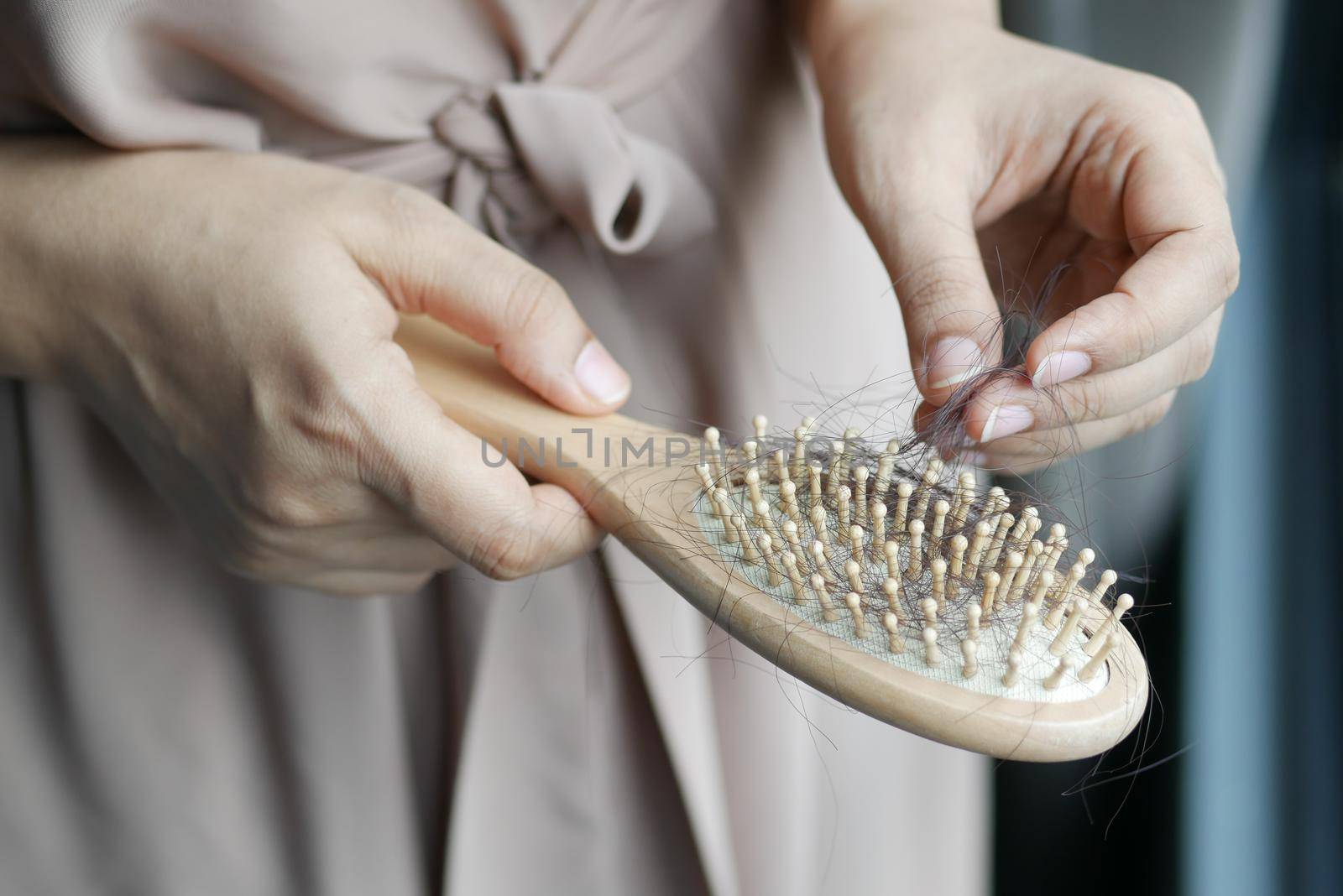 women hold her lost hair close up ,