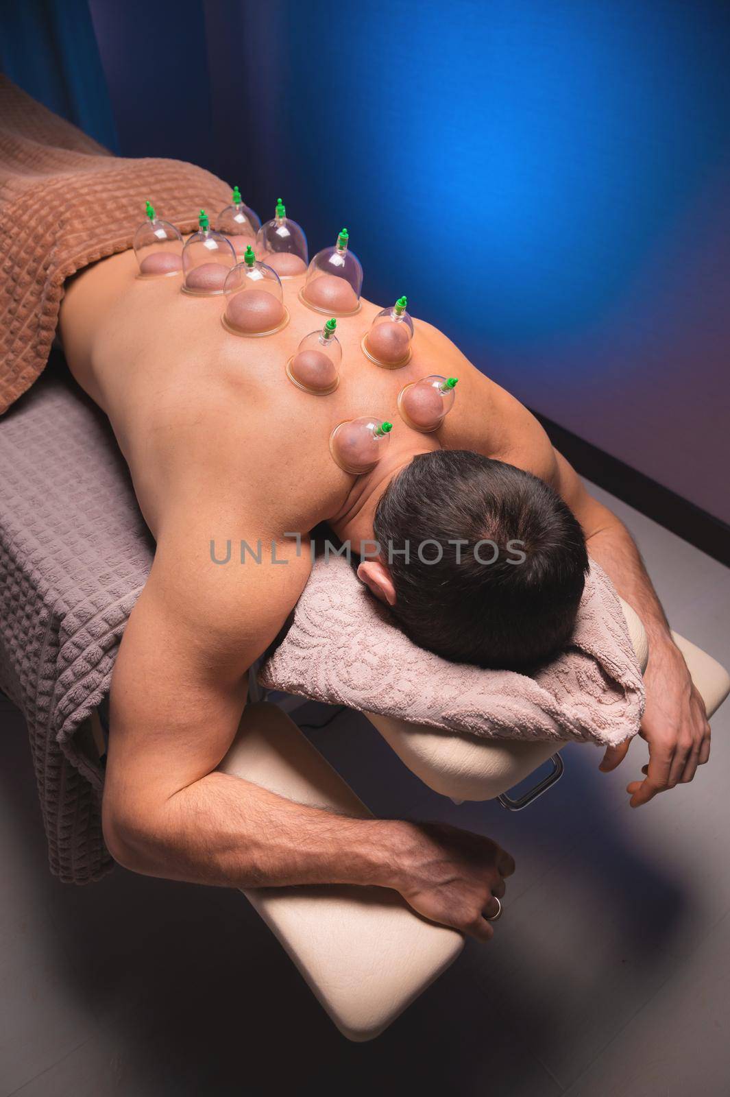 Vertical shot Relaxed young muscular man getting cupping treatment on his back lying on table by yanik88