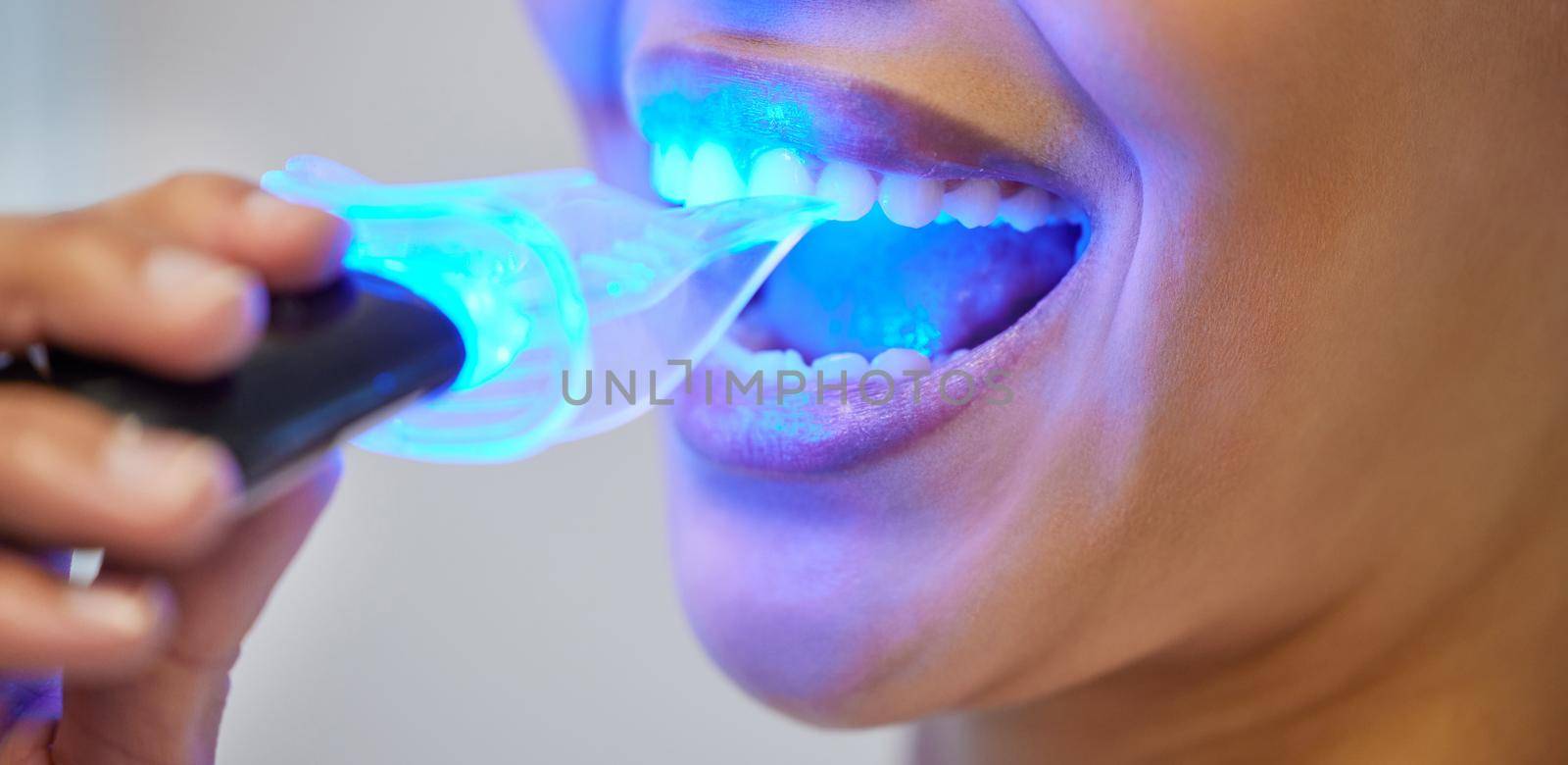 The fastest and safest approach to teeth whitening. an unrecognisable woman having her teeth whitened at the dentist. by YuriArcurs