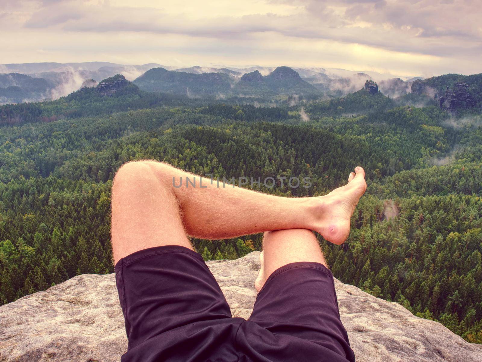 Big bloody callus on man's heel. Closeup of man feet relax on rocky summit at edge. Man enjoy view into country