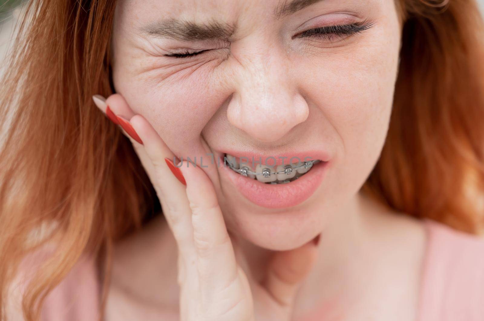 Young red-haired woman with braces suffering from pain