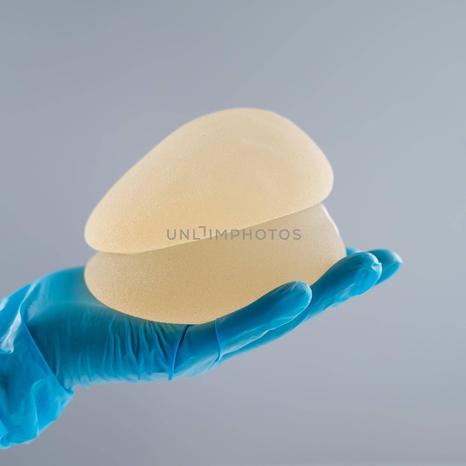 Doctor in a rubber glove holding a pile of breast implants. by mrwed54