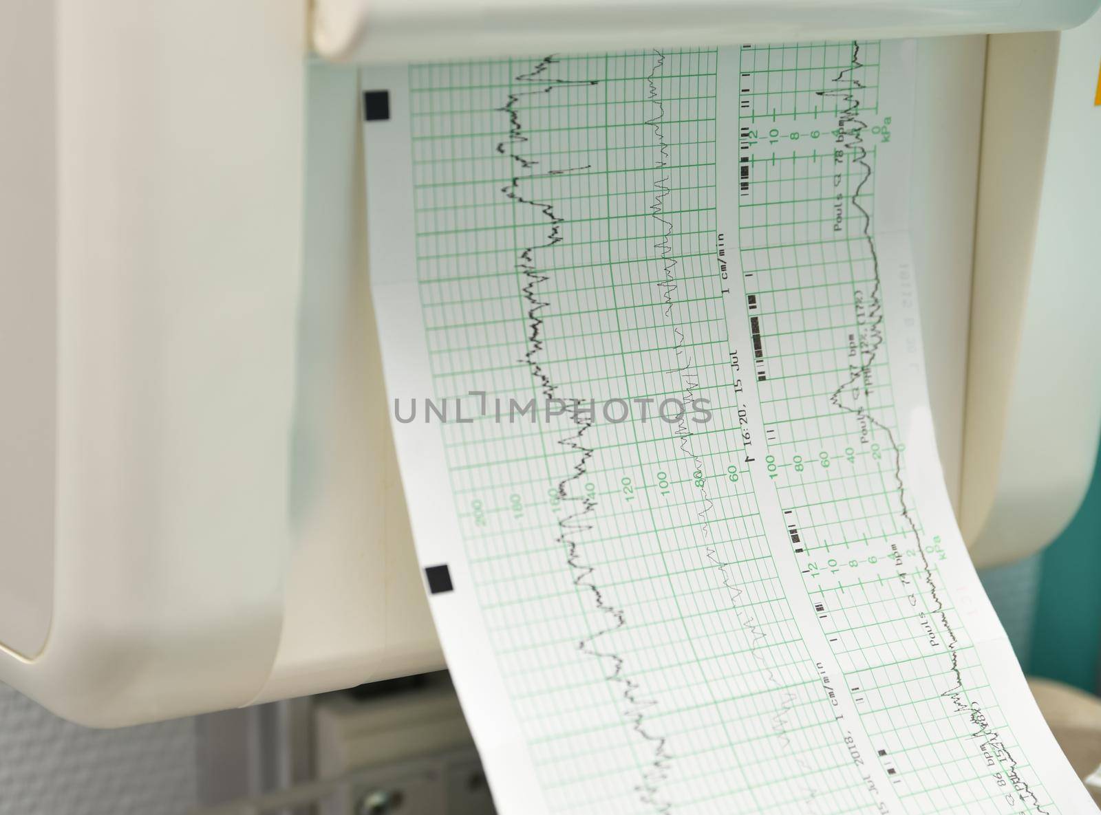 Monitor for measuring contractions and heartbeat of a pregnant woman