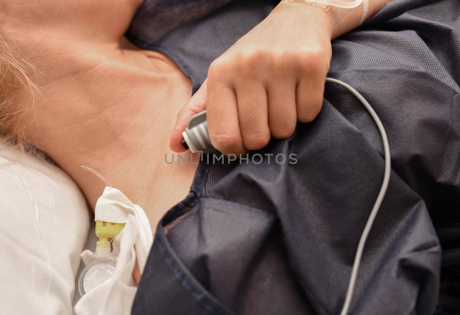 The woman push a button for a regular dose of epidural anesthesia