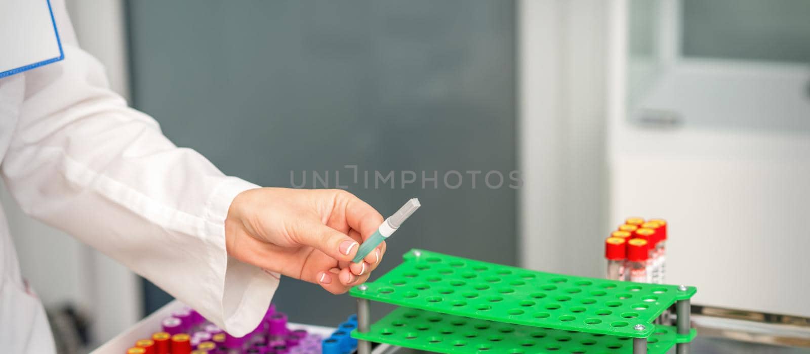 Female doctor's hands prepare tools for blood sampling in the lab