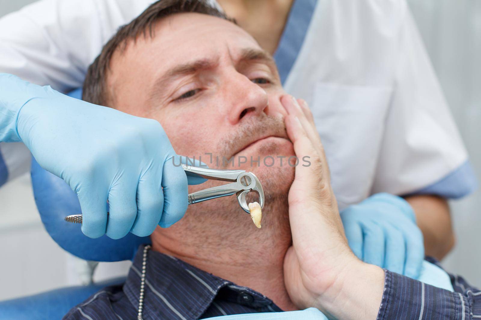 Dentist has extracted a sick tooth from patient in dental office. Focus on stainless steel dental tongs or pliers and extracted lower tooth in it. Dentistry