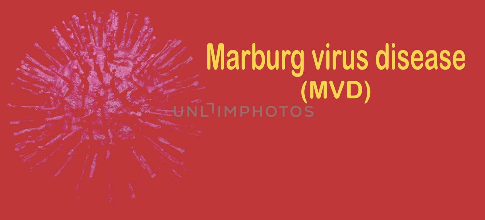 Marburg virus disease. Marburg virus disease (MVD) or Marburg haemorrhagic fever outbreak concept. Virus causes severe viral haemorrhagic fever in humans. Fatal illness in humans. Infectious disease. by Fahroni