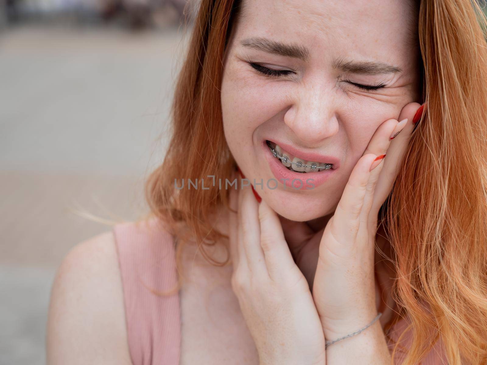 Young red-haired woman with braces suffering from pain. by mrwed54