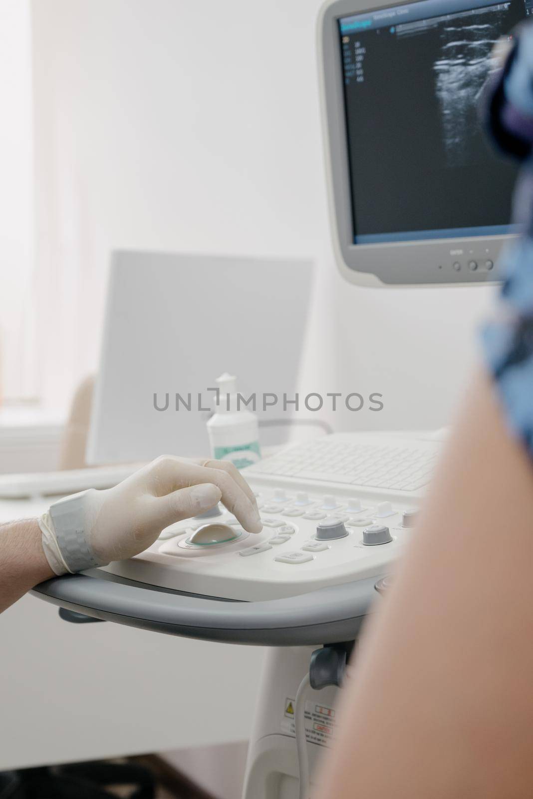 The doctor uses an ultrasound device to study the condition of the veins.Modern ultrasound monitor. Ultrasonography machine. High technology medical and healthcare equipment.