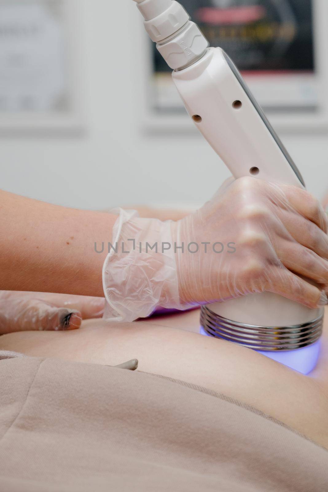 A woman in a beauty salon receives a vacuum abdominal massage, Hardware cosmetology.Hardware cosmetology for skin care and body contouring