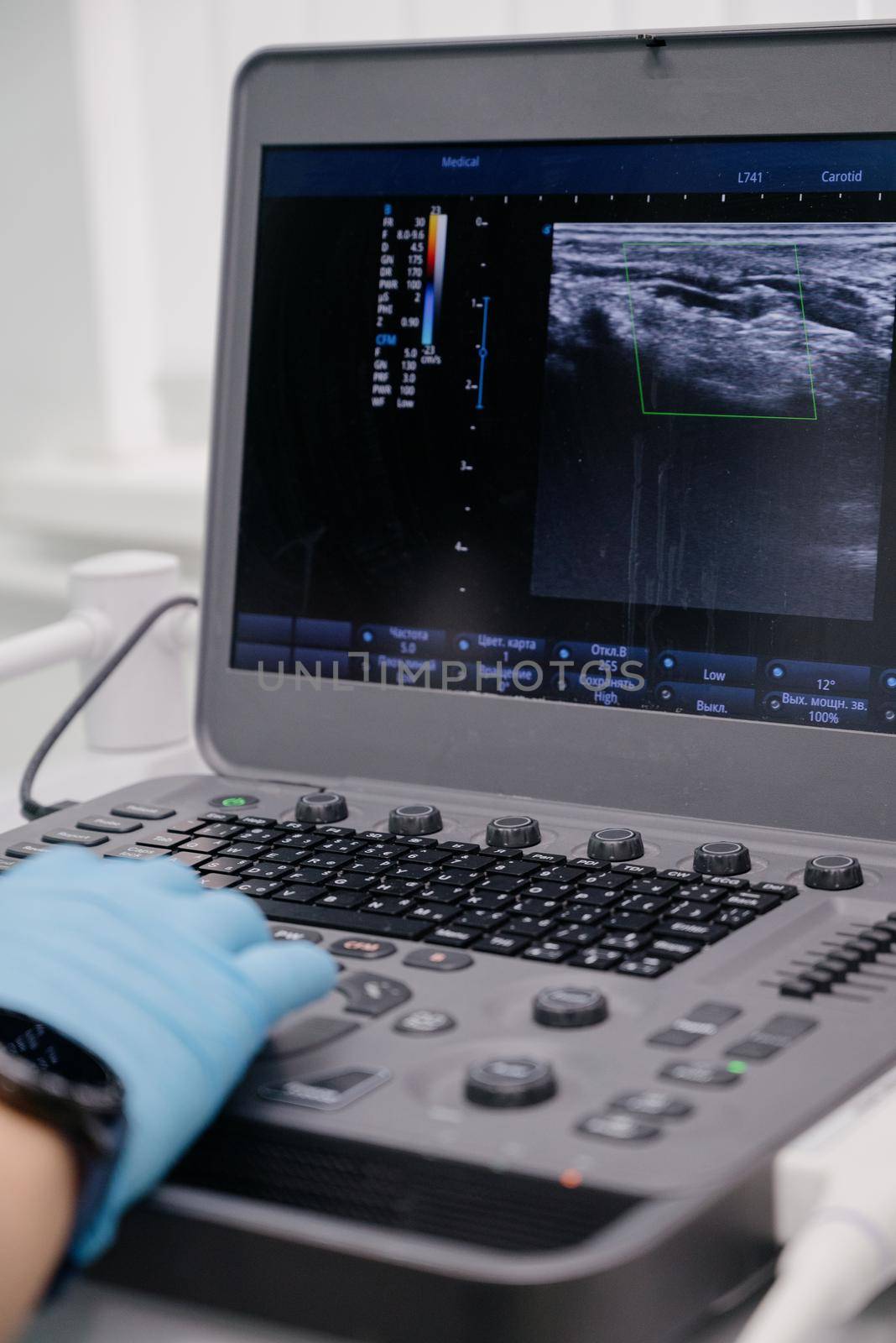 The doctor uses an ultrasound device to study the condition of the veins.Modern ultrasound monitor. Ultrasonography machine. High technology medical and healthcare equipment.