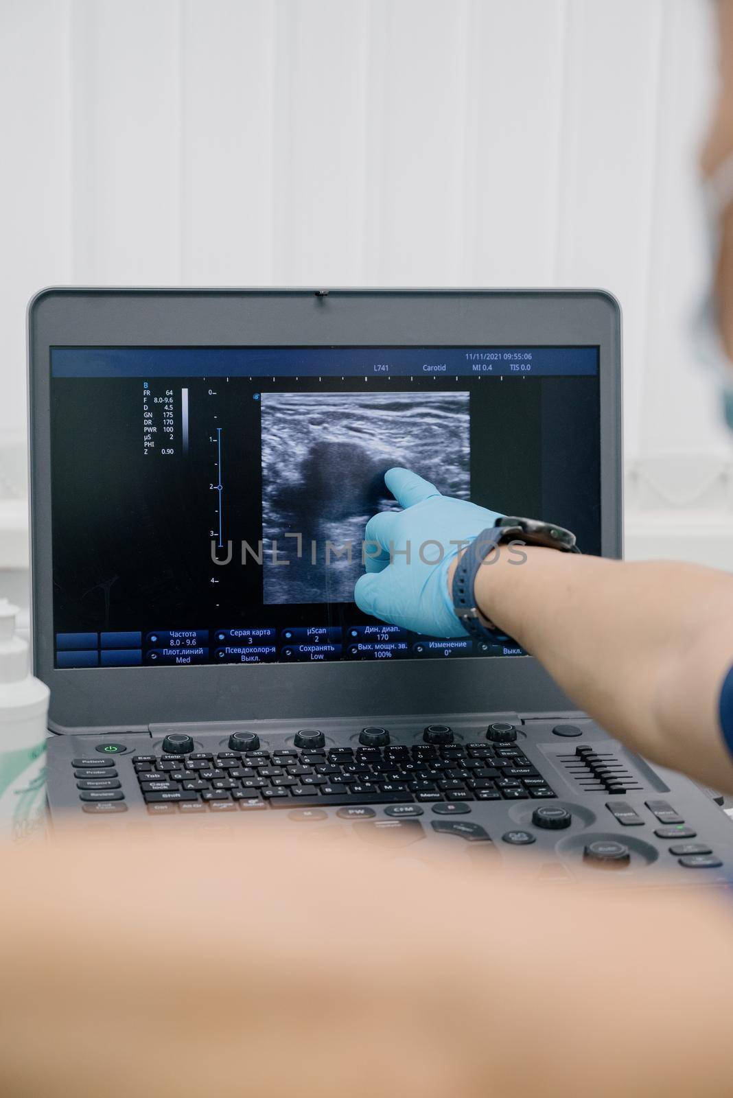 The doctor uses an ultrasound device to study the condition of the veins.Modern ultrasound monitor. Ultrasonography machine. High technology medical and healthcare equipment.