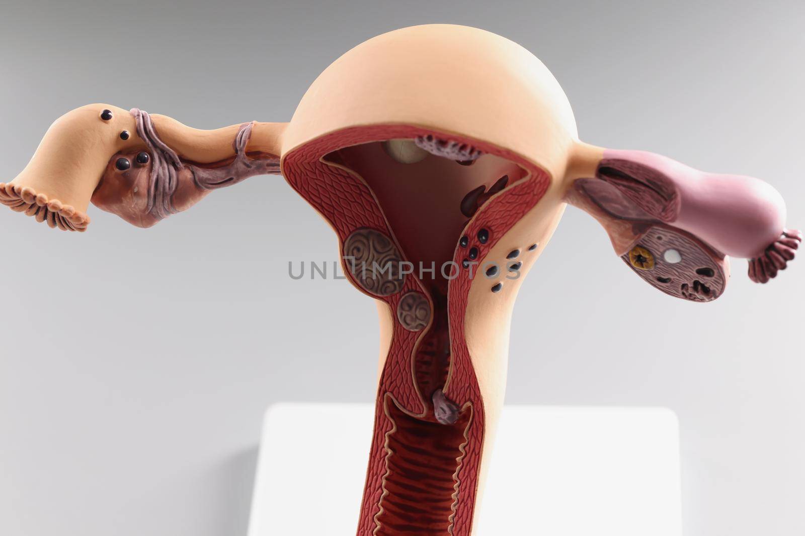 Close-up of anatomical model of womans uterus and ovaries, human reproductive organs, healthy female reproductive system, conception, education concept