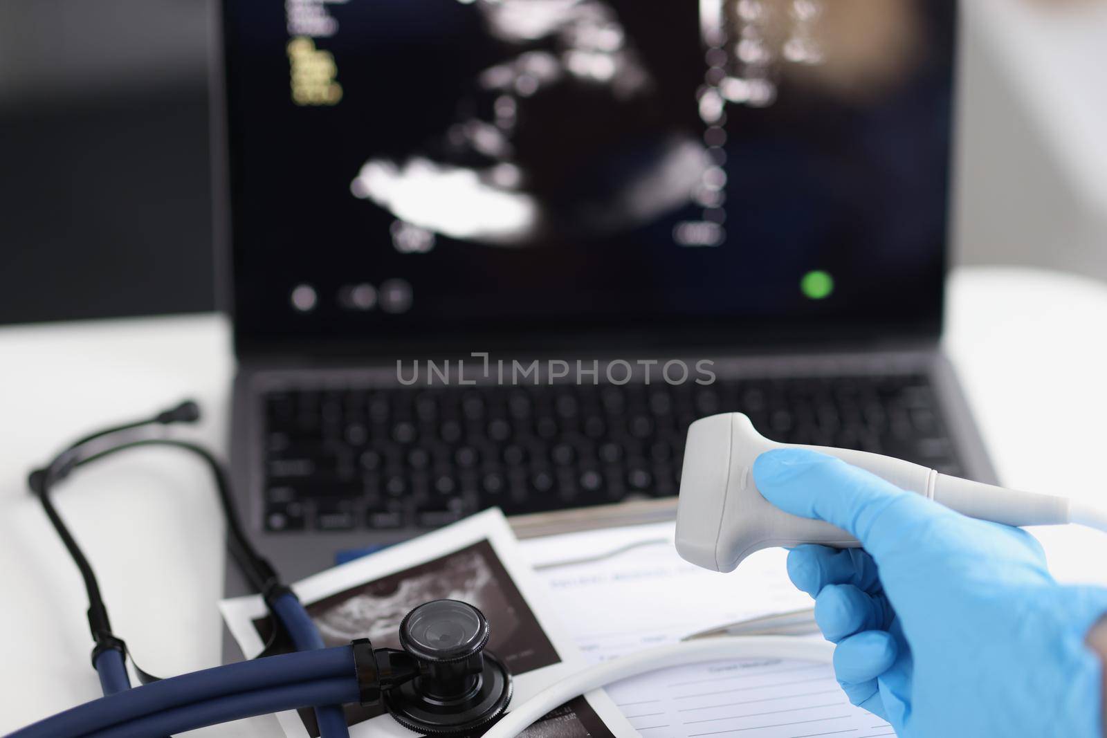 Close-up of medical equipment in clinic, modern ultrasound machine, scanners and sensors. Skillful sonographer at work. Medicine, scanning, health concept
