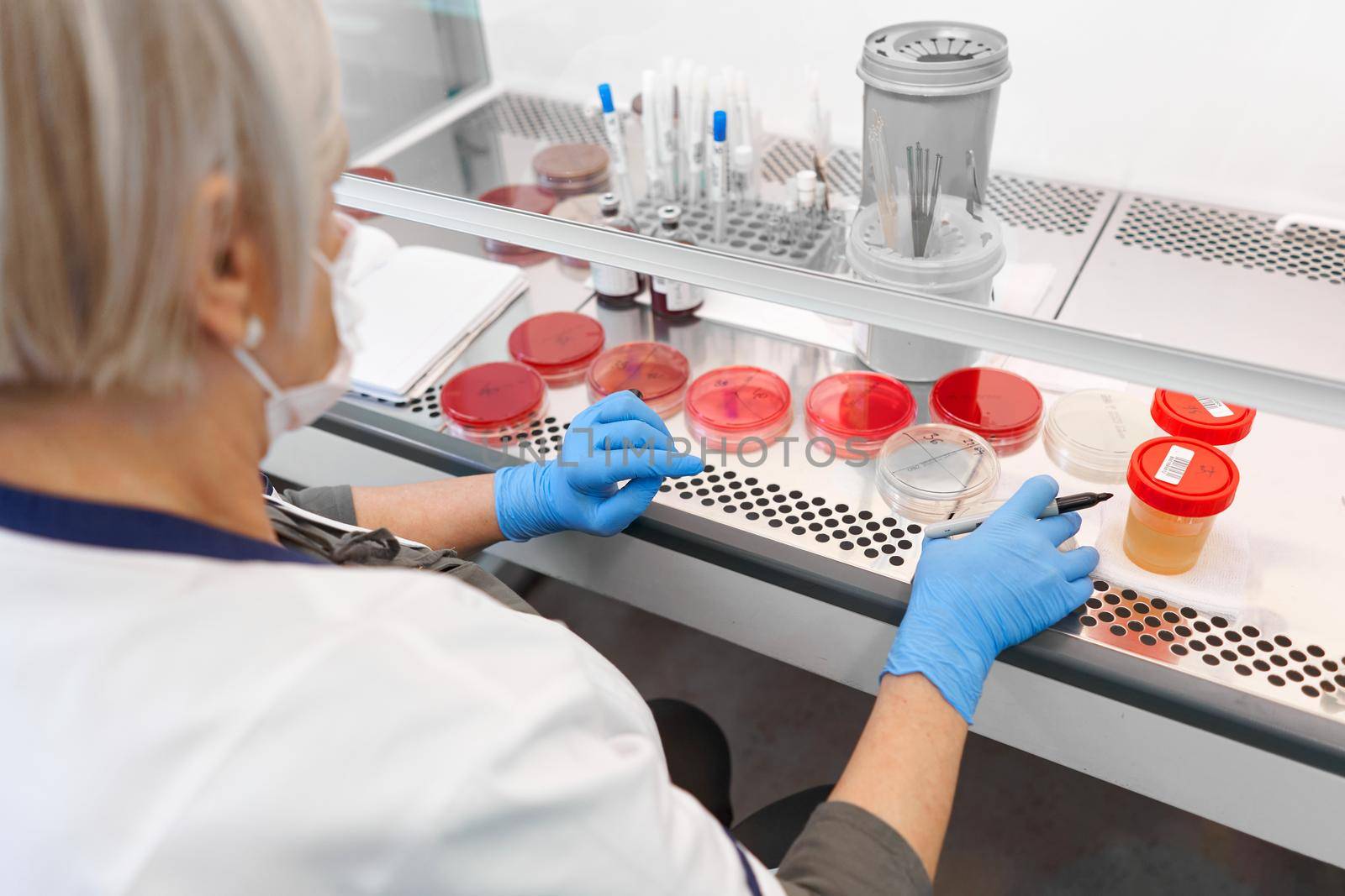 Back of a female laboratory technician organizing samples of cell cultivation in an hospital